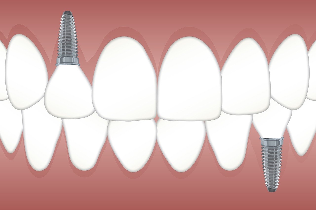 Affordable-Dental.jpg