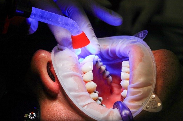 Laser treatment can help cancer patients with mouth sores