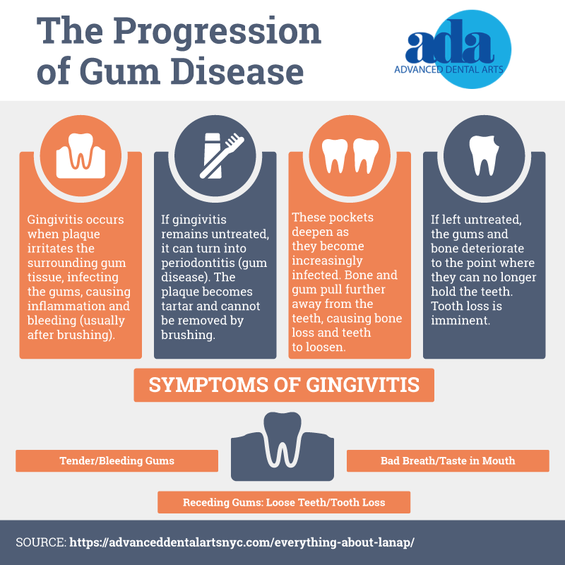 the progression of gum disease