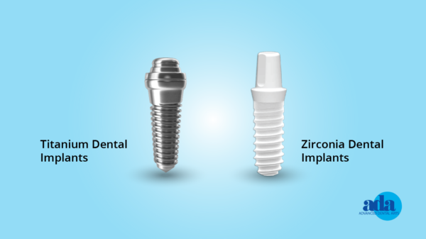 titanium vs zirconia dental implants
