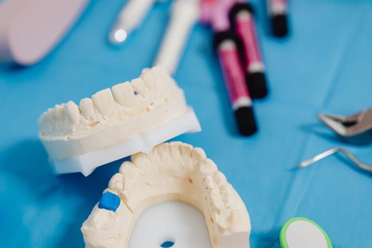 Dental bridges vs dental implants