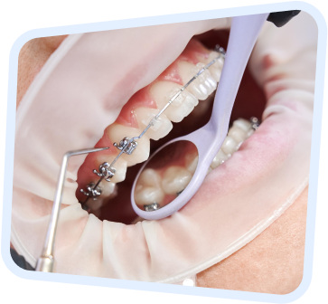 a close up of a person holding a pair of scissors to their teeth