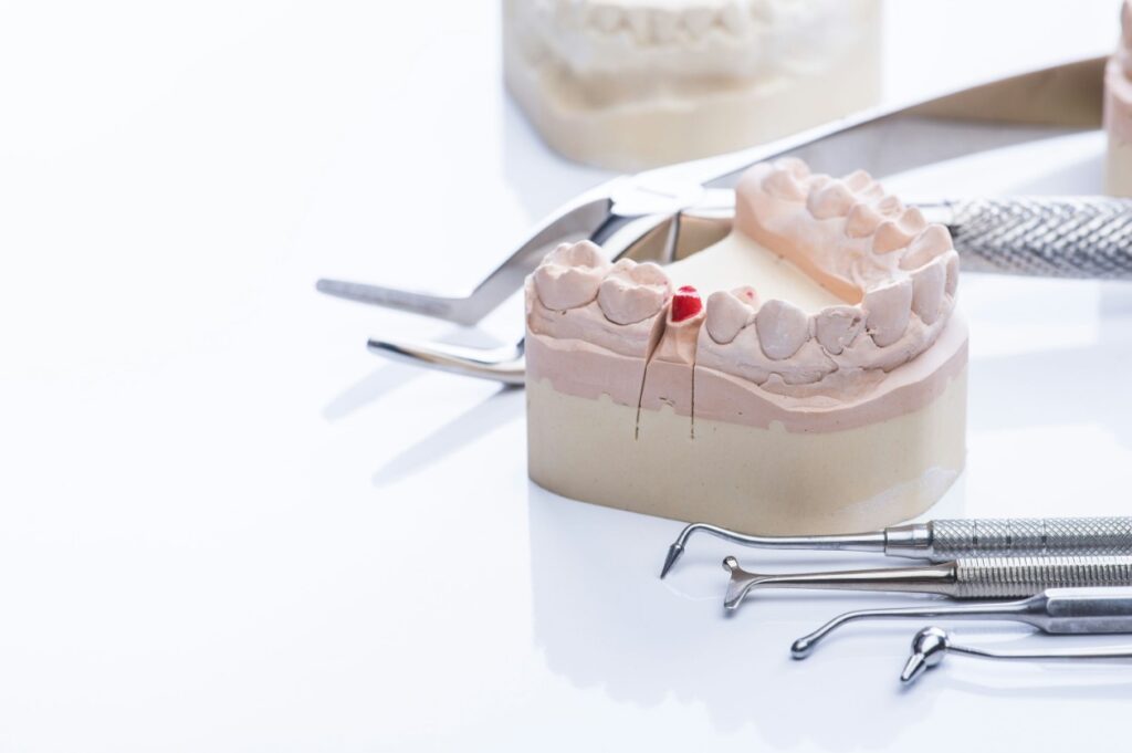 a close up of a model of a tooth with dental tools