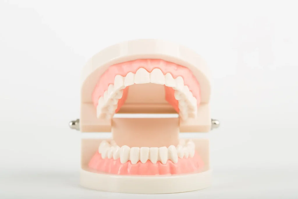 there is a model of a mouth with a missing tooth