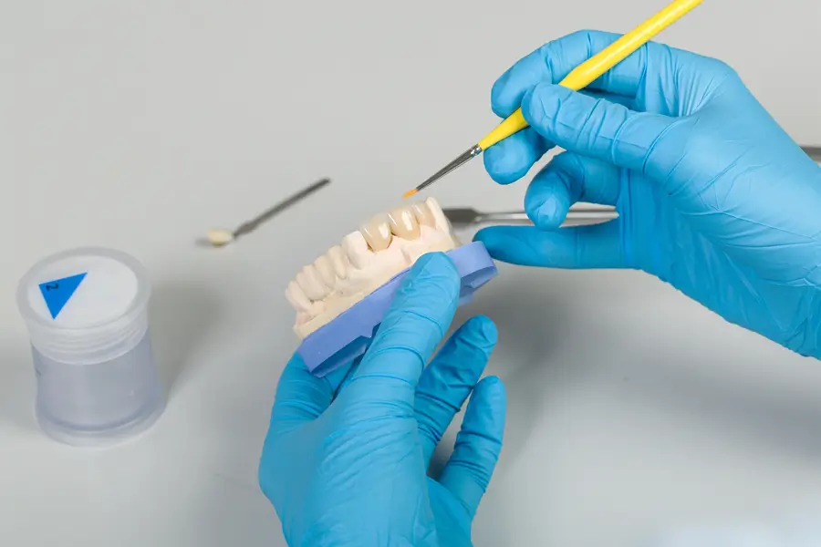The Latest Innovations in Veneer Procedures: What to Expect