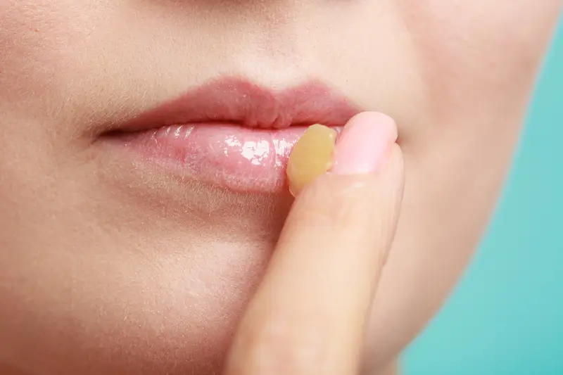 Cold Sores 101: What They Are and How Laser Therapy Can Help 