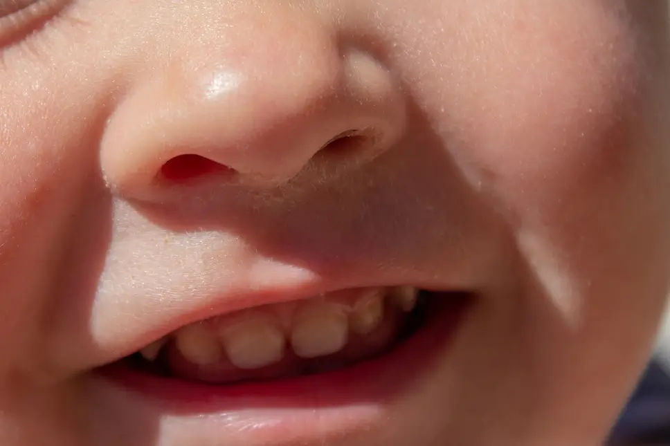 Why Do Babies Grind Their Teeth