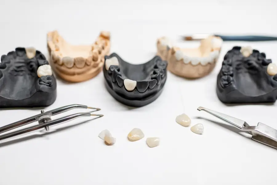 How Do Veneers Work? Key Facts from Advanced Dental Arts NYC